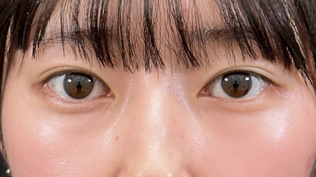 Postoperative Condition Part 1