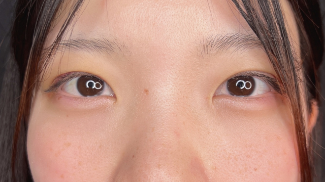 Postoperative Condition Part 1