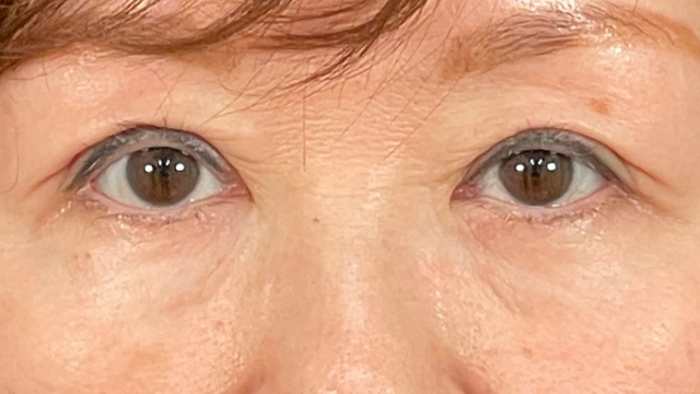 Postoperative Condition Part 1