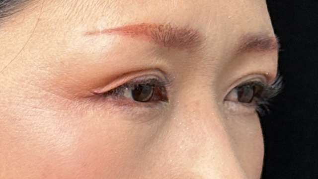 Postoperative Condition Part 1