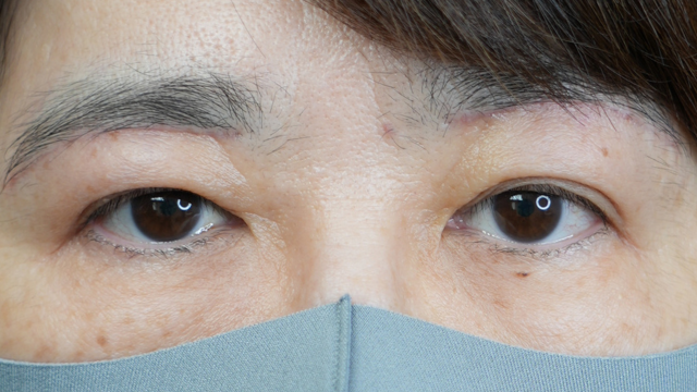 Postoperative Condition Part 1