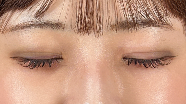 Postoperative Condition Part 1