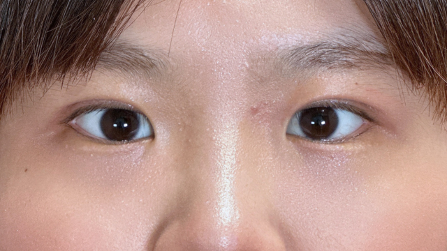 Postoperative Condition Part 1