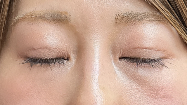 Postoperative Condition Part 1