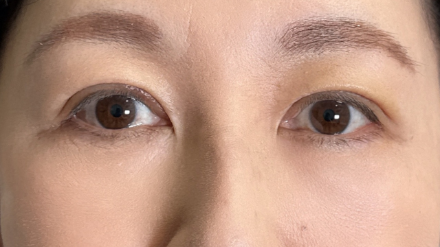 Postoperative Condition Part 1