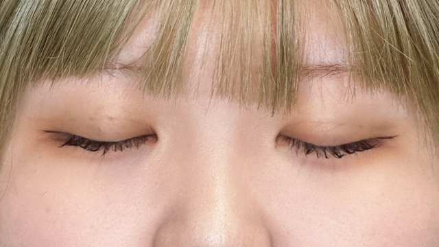 Postoperative Condition Part 1