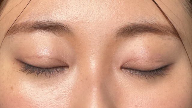 Postoperative Condition Part 1