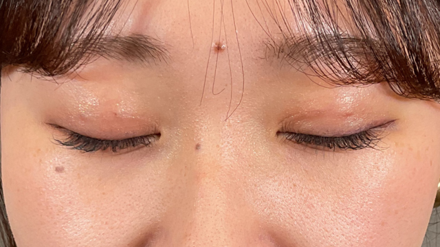 Postoperative Condition Part 1