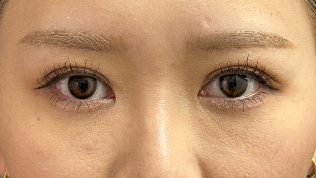 Postoperative Condition Part 1