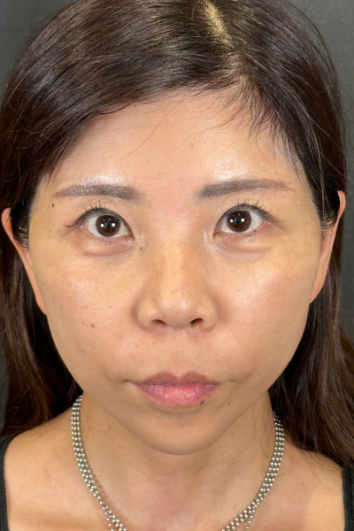 Postoperative Condition Part 1