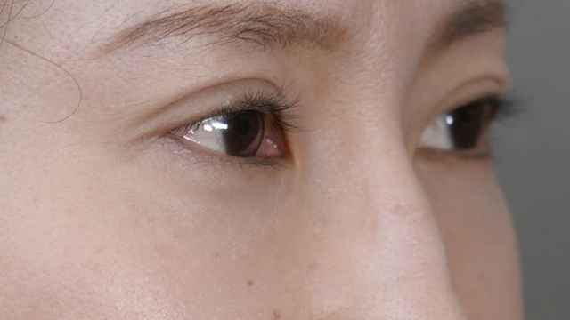 Postoperative Condition Part 1