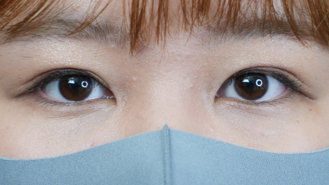 Postoperative Condition Part 1