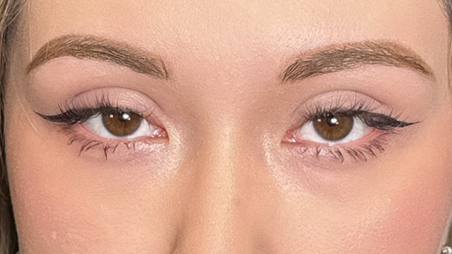 Postoperative Condition Part 1