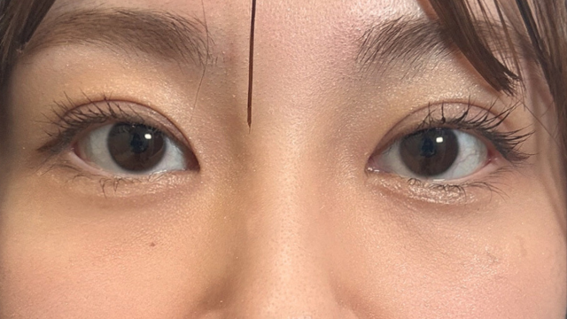 Postoperative Condition Part 1