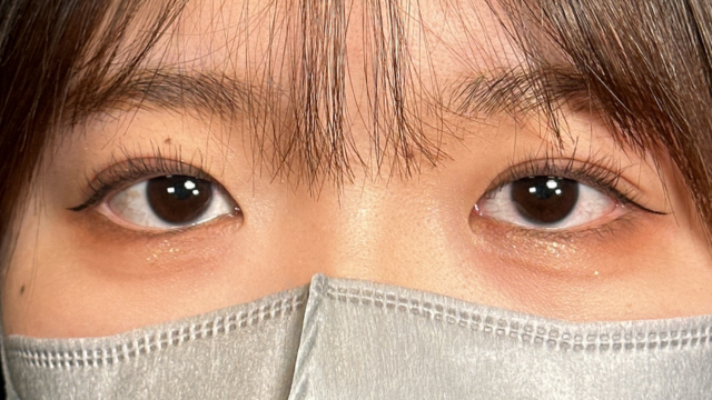 Postoperative Condition Part 1