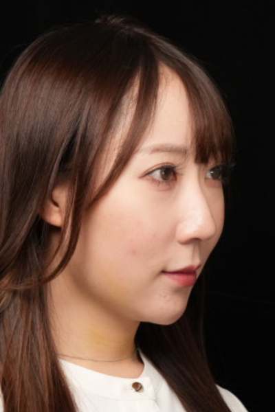 手術前の状態 その1