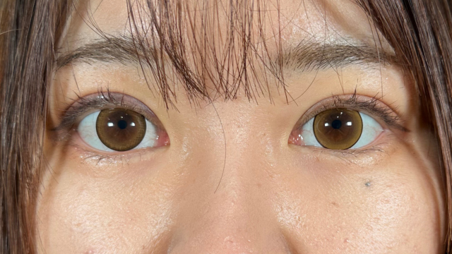 Postoperative Condition Part 1