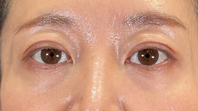 Postoperative Condition Part 1