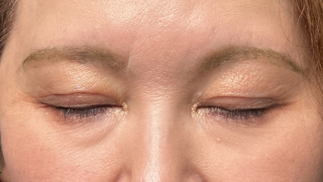 Postoperative Condition Part 1