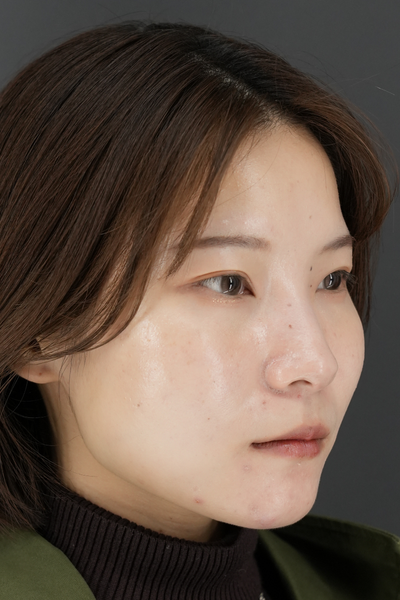 Postoperative Condition Part 1