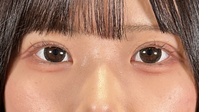 Postoperative Condition Part 1