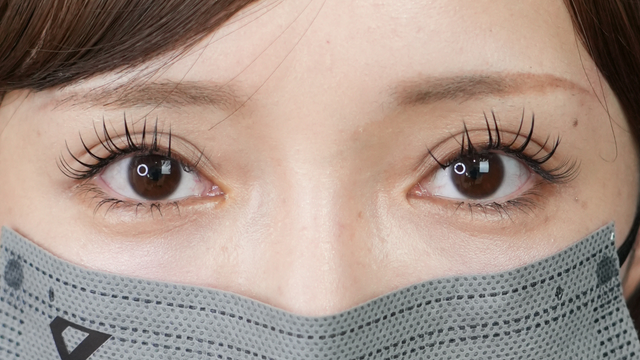 Postoperative Condition Part 1