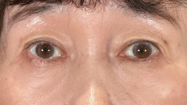 Postoperative Condition Part 1