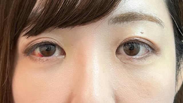 Postoperative Condition Part 1