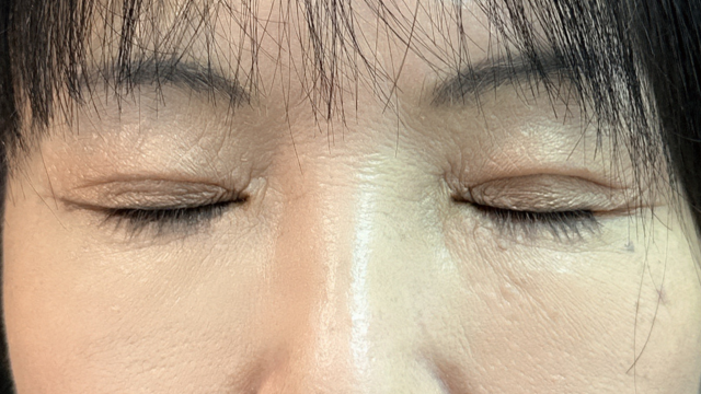 Postoperative Condition Part 1