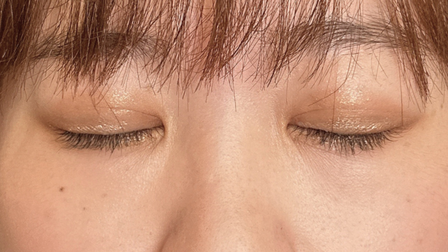 Postoperative Condition Part 1