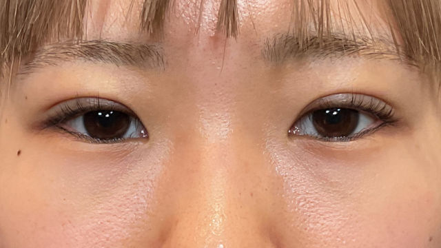 Postoperative Condition Part 1