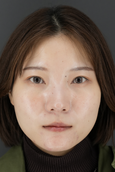 Postoperative Condition Part 1