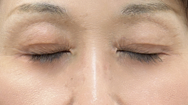 Postoperative Condition Part 1