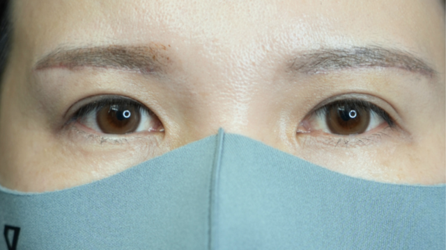 Postoperative Condition Part 1