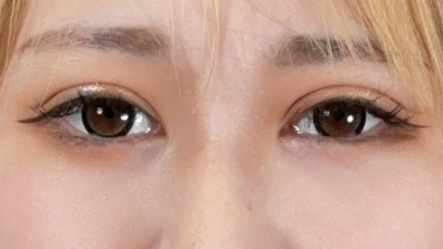 Postoperative Condition Part 1