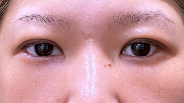 Postoperative Condition Part 1