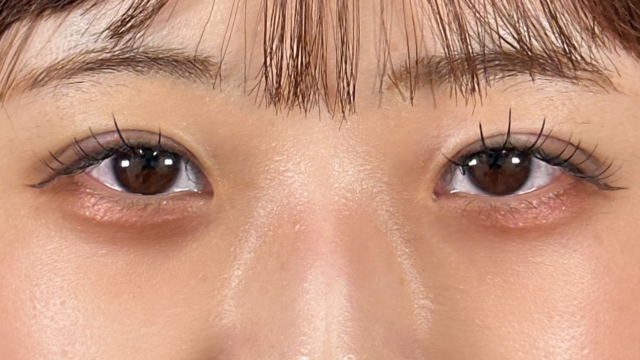 Postoperative Condition Part 1