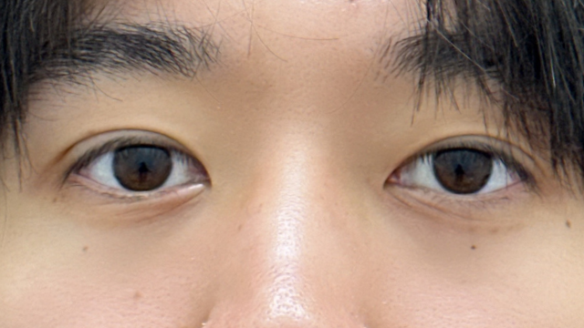 Postoperative Condition Part 1