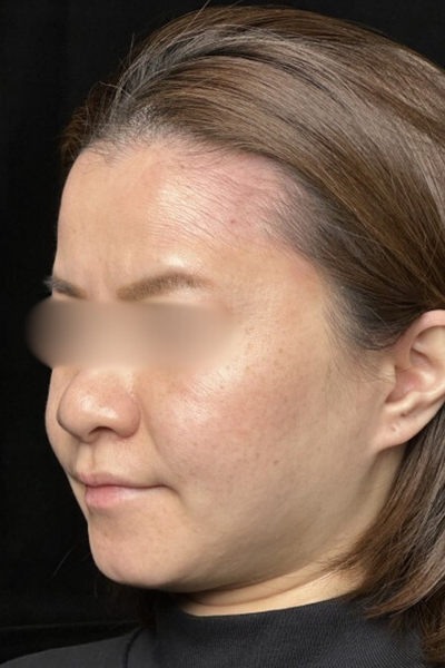 手術前の状態 その1