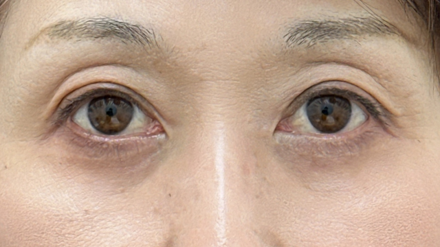 Postoperative Condition Part 1