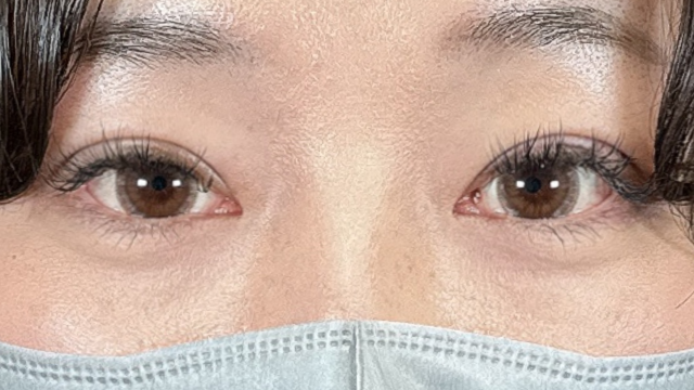 Postoperative Condition Part 1