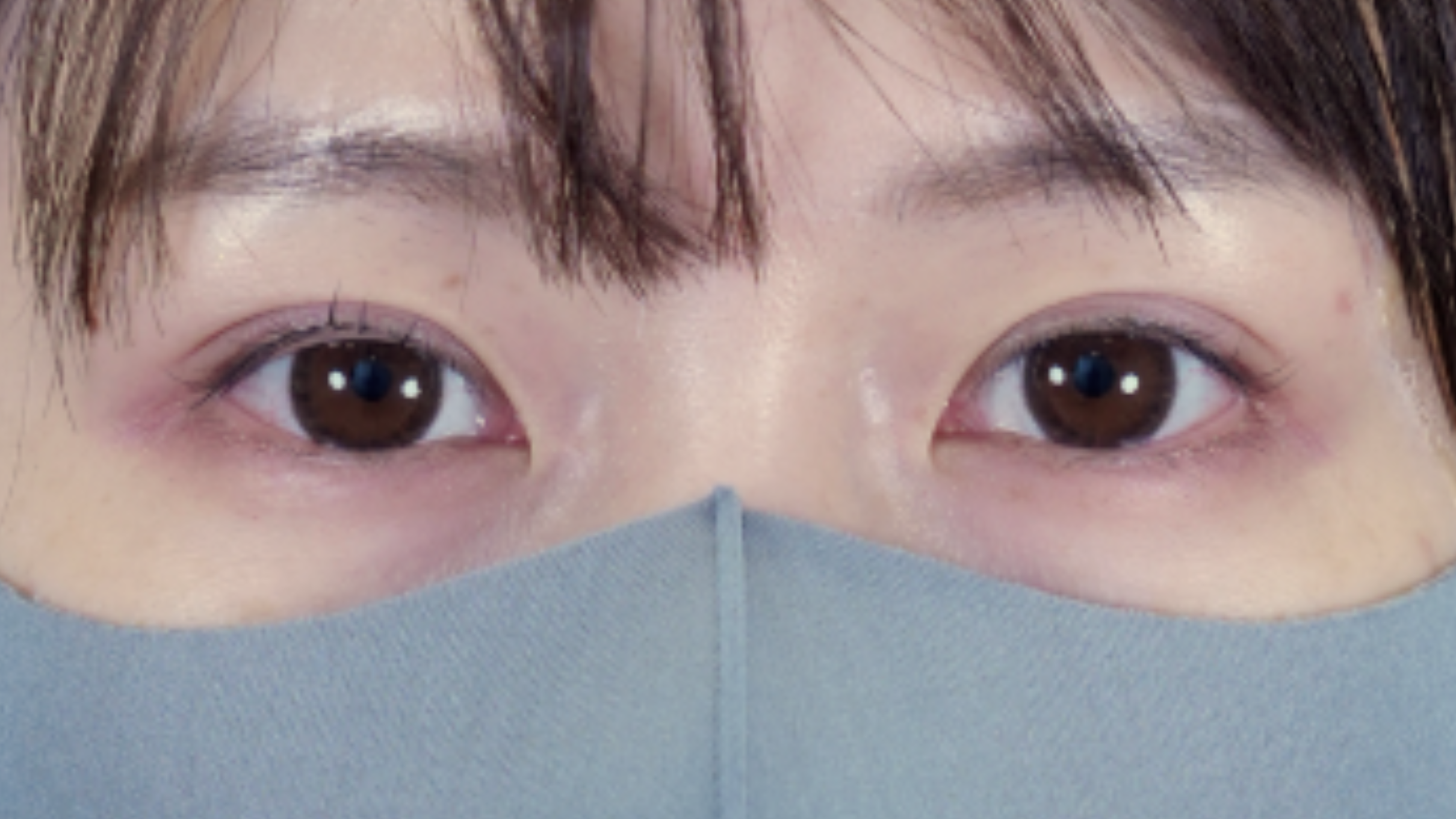 Postoperative Condition Part 1