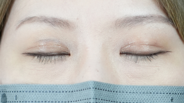 Postoperative Condition Part 1