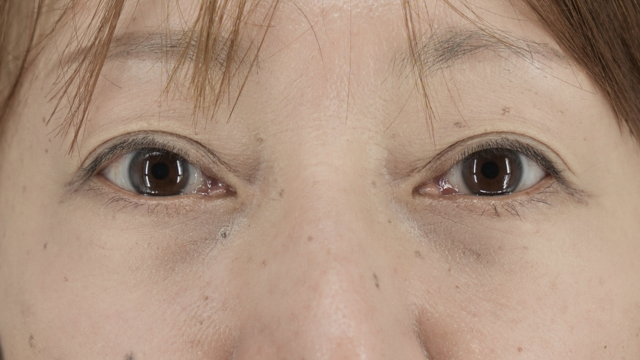 Postoperative Condition Part 1