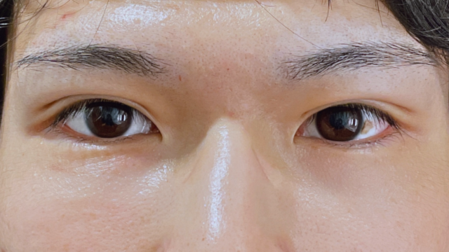 Postoperative Condition Part 1