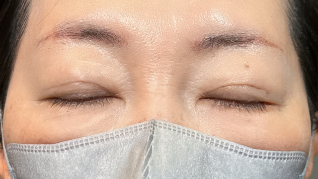 Postoperative Condition Part 1