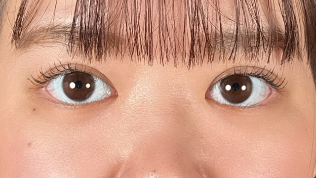 Postoperative Condition Part 1