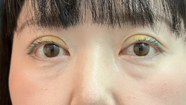 Postoperative Condition Part 1