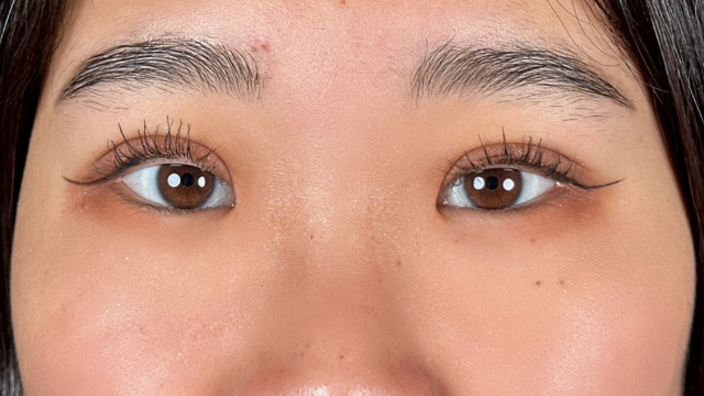 Postoperative Condition Part 1