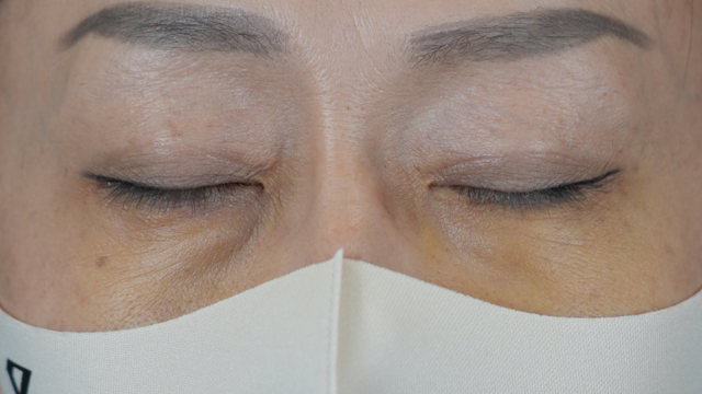 Postoperative Condition Part 1